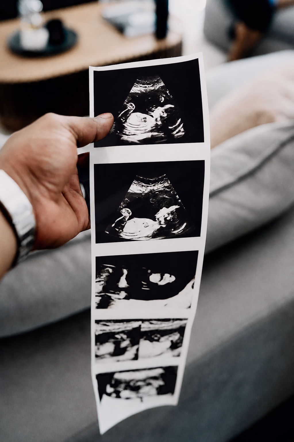 Ultrasound